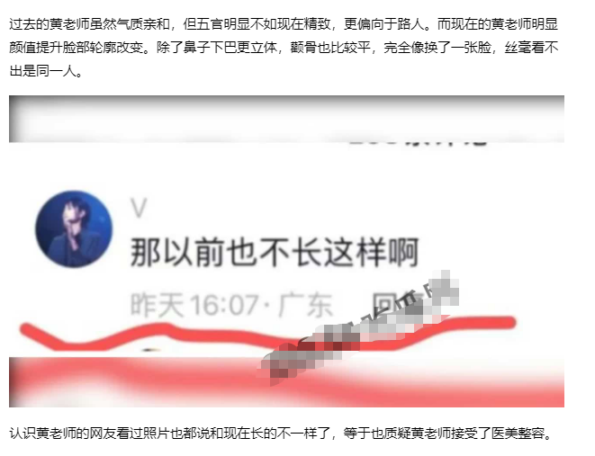 「挖呀挖老师」甜美笑眼全靠滤镜？ 前同事爆料整容前照片 爆红后「从身分→颜质」遭全方位抹黑 直播中不禁落泪
