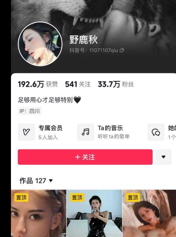 抖音网红「野鹿秋」33W气质博主